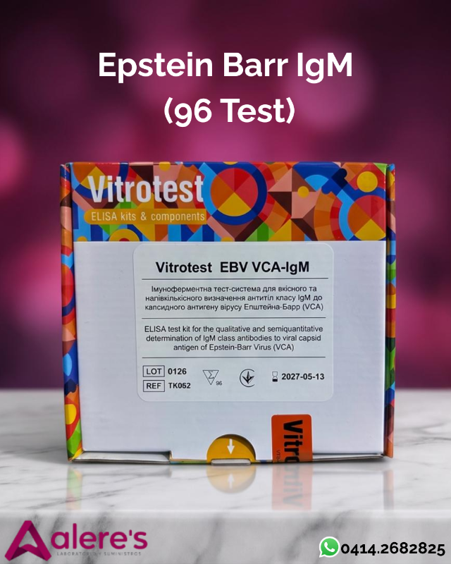 Epstein Barr EBV IgM